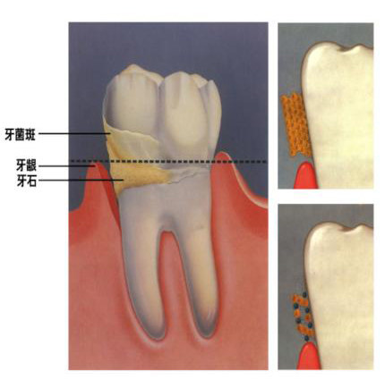 一白遮百丑，烂牙毁所有，宝鸡人的面子，就在一口牙上