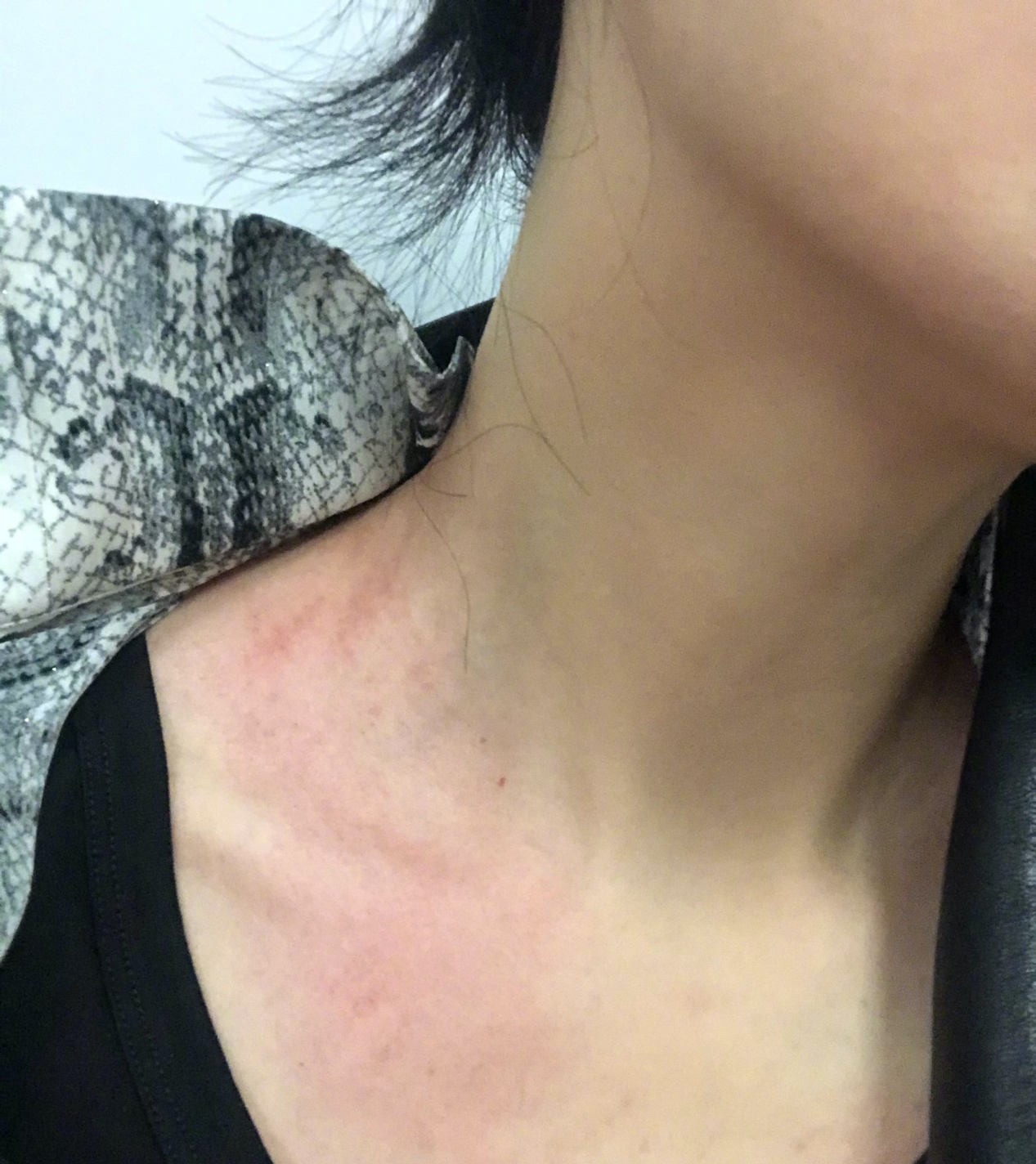 军嫂张馨予晒照，自曝练习主持到喉咙沙哑，狂吃药到皮肤过敏