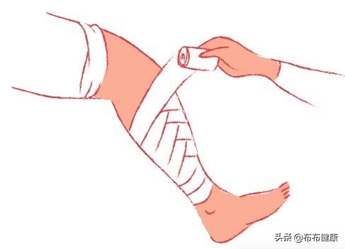 专家级指导:外伤后如何包扎伤口