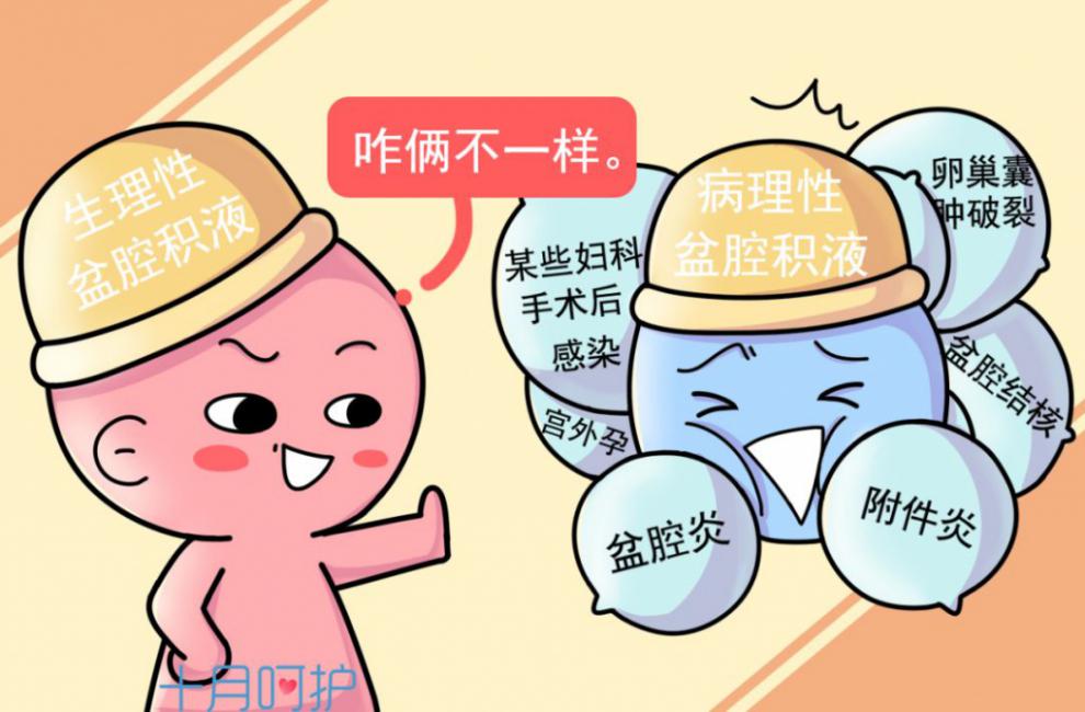 每个女人都会遇到哪些妇科病,常见的女性妇科问题