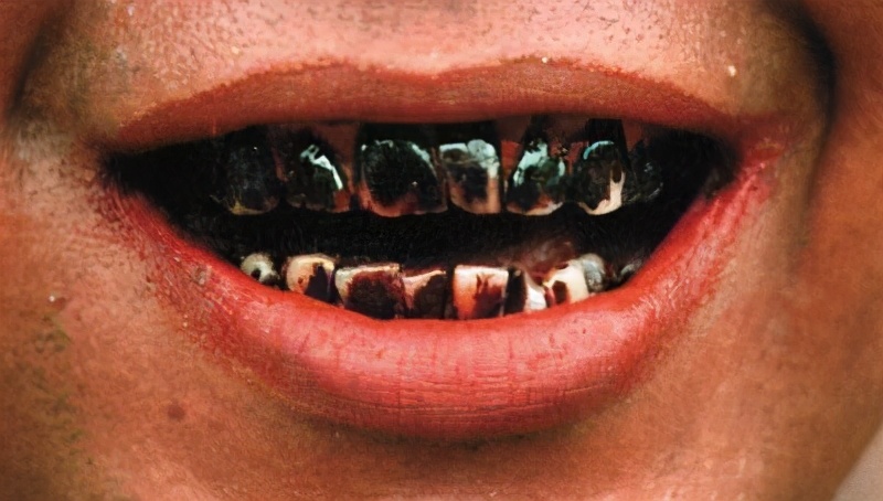 致癌物槟榔消费者超1亿,槟榔公认软毒品