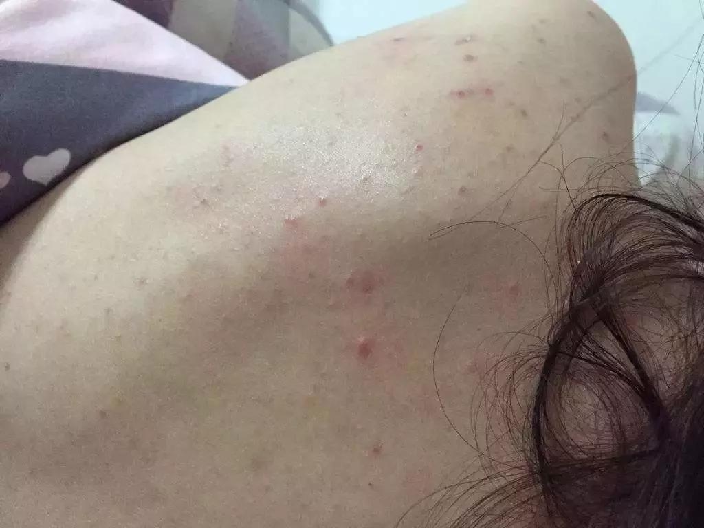 一块驴奶皂搞定洁面、卸妆,还能洗澡去鸡皮!我要回购10000次