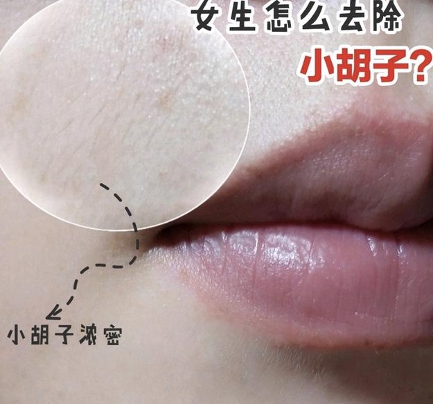 “闺蜜看见我脱毛,说我心机太重”