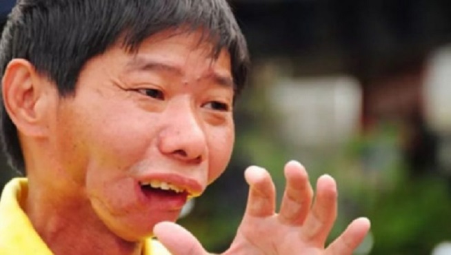 槟榔产业医疗负担远超经济效益,槟榔产业目前已近千亿产值