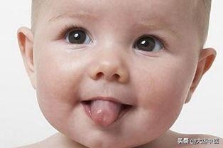 宝宝舌头能反映什么病,看孩子的舌头知道身体状况