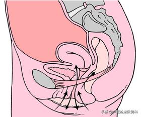 怎么锻炼盆底肌凯格尔运动,盆底肌训练凯格尔运动教程