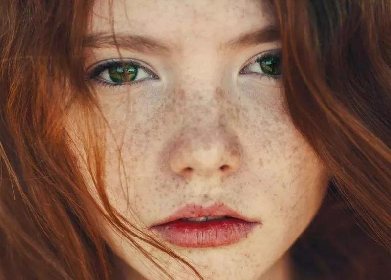 女人脸上长黄斑的原因和调理方法,女性绝经后脸上出现雀斑怎么调理