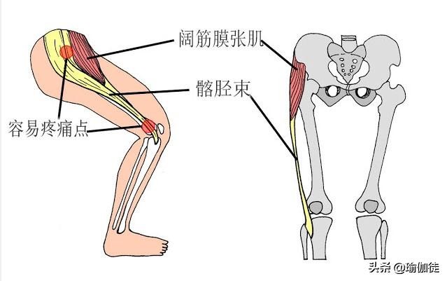 髋关节病变膝关节痛,髋关节疼痛与脏器的关系
