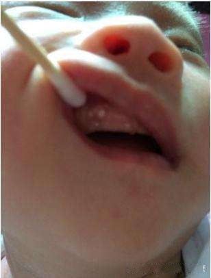 害怕宝宝睡觉受惊?看完后家长再也不用担心宝宝的这几种生理现象