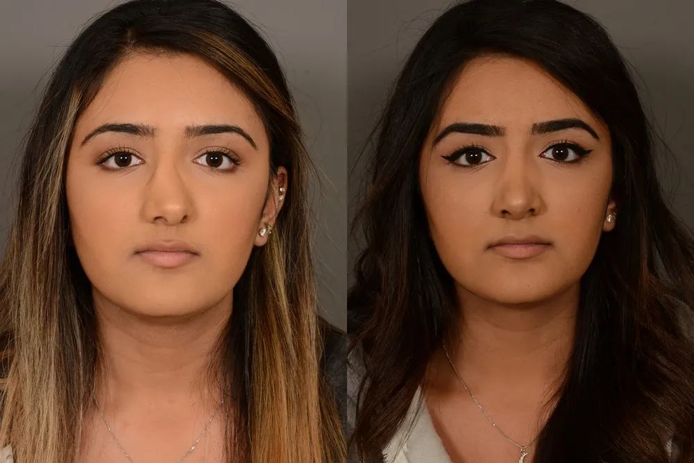 空鼻症杀医事件存活医生,空鼻症杀医事件怎么判的