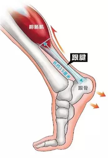 喹诺酮药物（工业合成抗生素）会引起跟腱断裂吗？