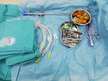 这个难言之隐，所有女生都不应该回避