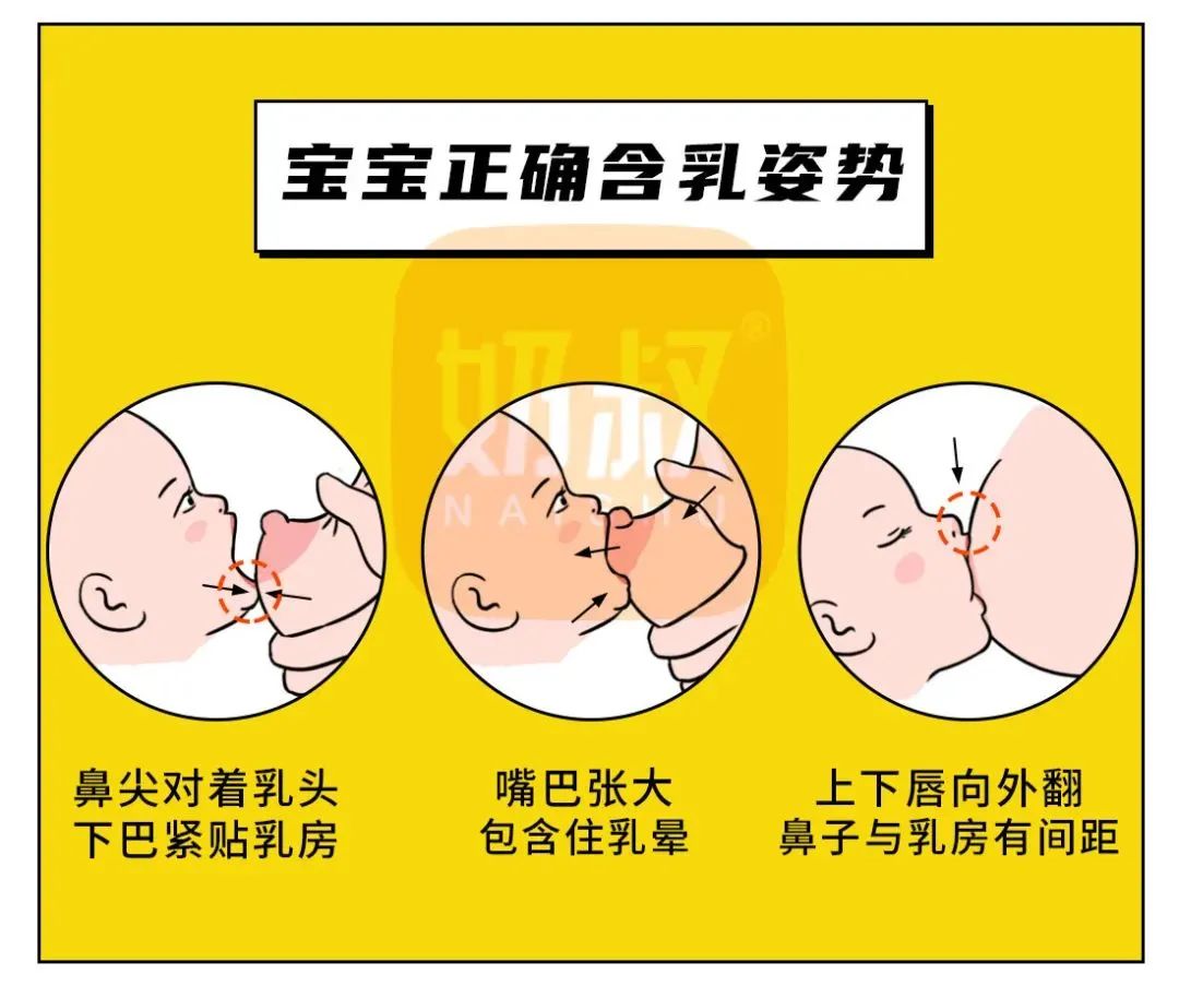 哺乳期碰到奶之后有点疼怎么办,哺乳皲裂疼痛有几级
