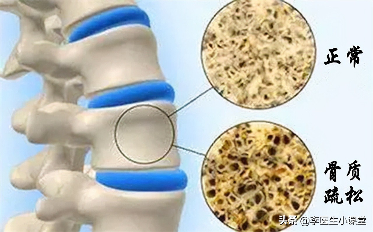 缺钙抽筋是哪里抽筋,年轻人晚上睡觉小腿抽筋是缺钙吗