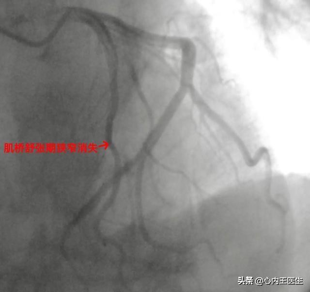 心慌发作怎么急救,反复心慌气短怎么回事