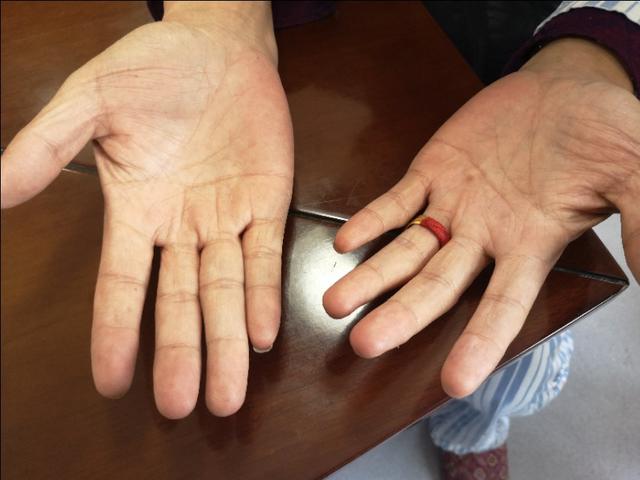 腹部胀满情志焦虑多梦易怒,腹部神经痛焦虑症