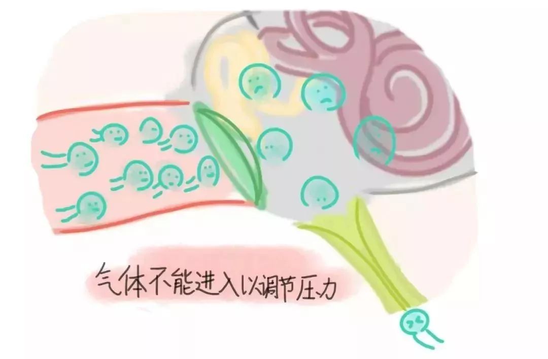 坐飞机耳朵堵了怎么快速通气妙招,坐飞机感觉耳朵里面跟堵住了一样