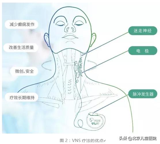 婴儿痉挛症治愈成功,婴儿痉挛症怎么读