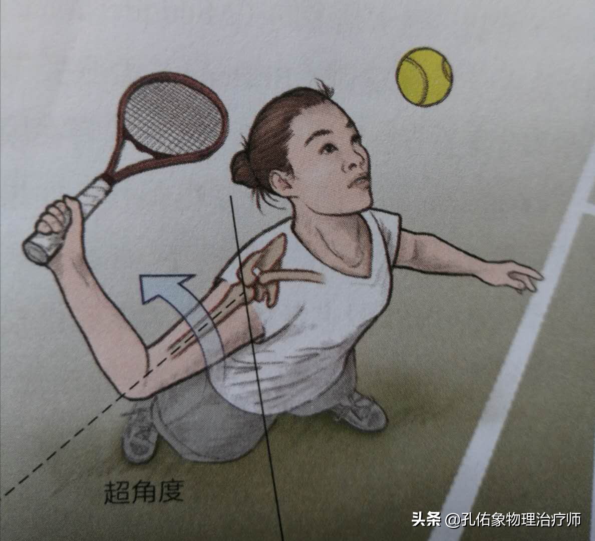 老年人肩周疼痛的厉害怎么治疗,老年人肩背部疼痛怎么回事