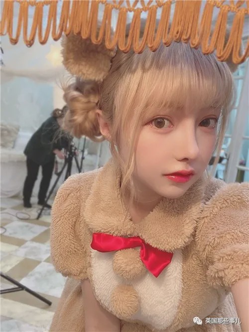 20岁漂亮女子花6万整容鼻子失败,19岁少女花百万整容