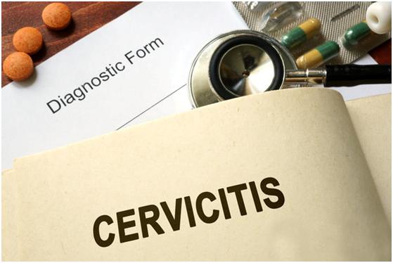 宫颈重度炎症可能影响怀孕，一定要注意