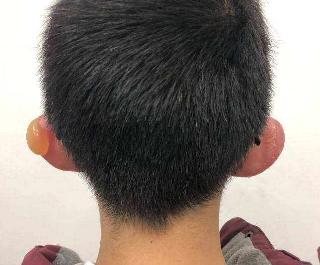 学生扫雪被同学意外铲伤怎么办,学生在学校扫雪意外受伤谁负责