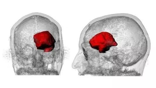 大脑感知出现问题了什么情况,大脑潜意识发出可怕的信息