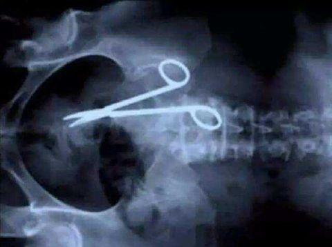 不作死就不会死,看看这些被人类搞进身体里的异物