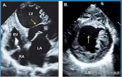 鍗庡尰蹇冭瘹鍖荤敓闆嗗洟鏈夐檺鍏徃,鍗庡尰蹇冭瘹鍖荤敓鐜扮姸