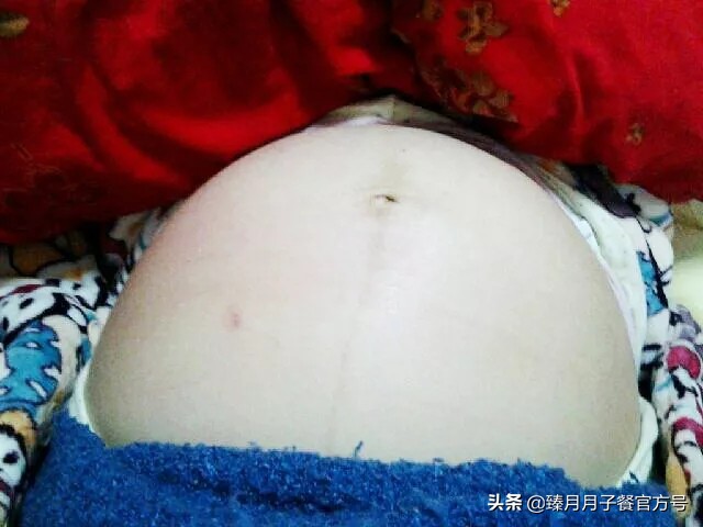 24年孕晚期需要准备的东西清单,孕晚期的5大烦恼该如何缓解