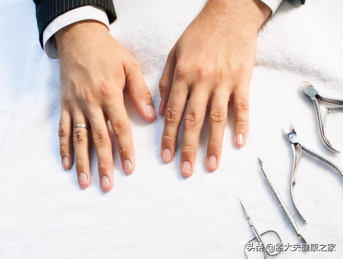 得了灰指甲怎么办才能治好,得了灰指甲怎样才能彻底治疗呢