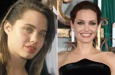 嘴型丑的怎样让嘴唇变得好看,嘴型不好看怎么练才能矫正