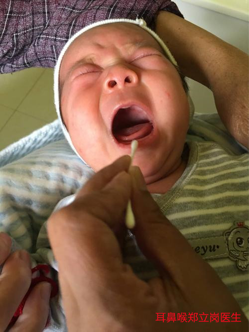 不小心鱼骨卡到喉咙里怎么办,鱼骨卡喉咙久了会化掉吗