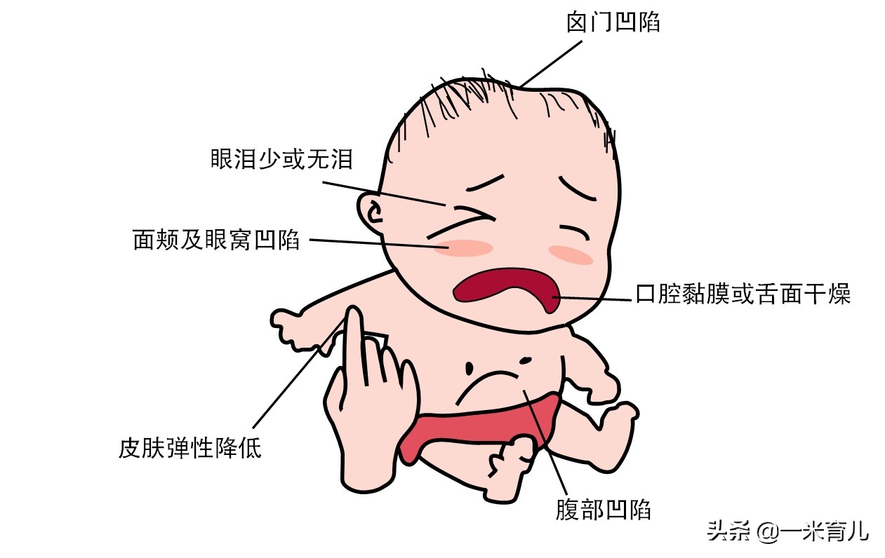 夏天婴幼儿经常腹泻怎么办？5步居家护理和预防措施，家长请收好