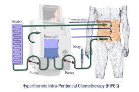 听专家说老年肿瘤怎么治,专家讲癌症