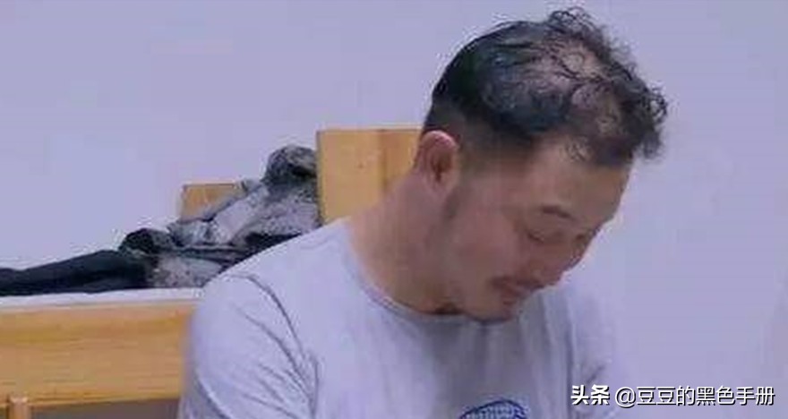 脑门大发际线高的女明星,大脸大脑门秃头女生适合的发型