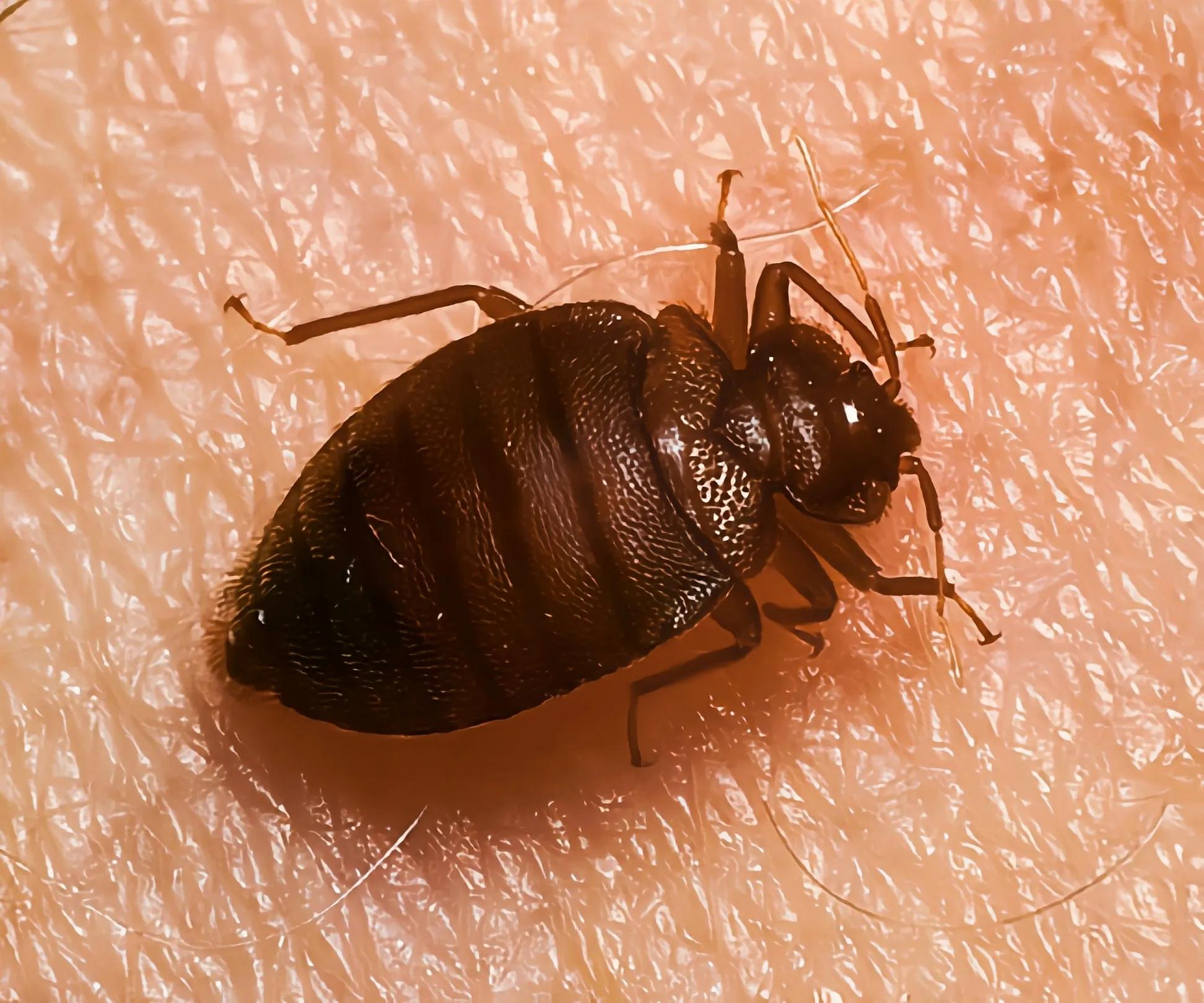 孩子被蚊虫叮咬了怎么办呢,被蚊虫叮咬后大面积红肿疼怎么办