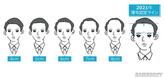 所以秃头的标准是发际线高≥7cm?头秃代表不再是中老年独扛大旗,90后、00后也在积极踊跃加入组织