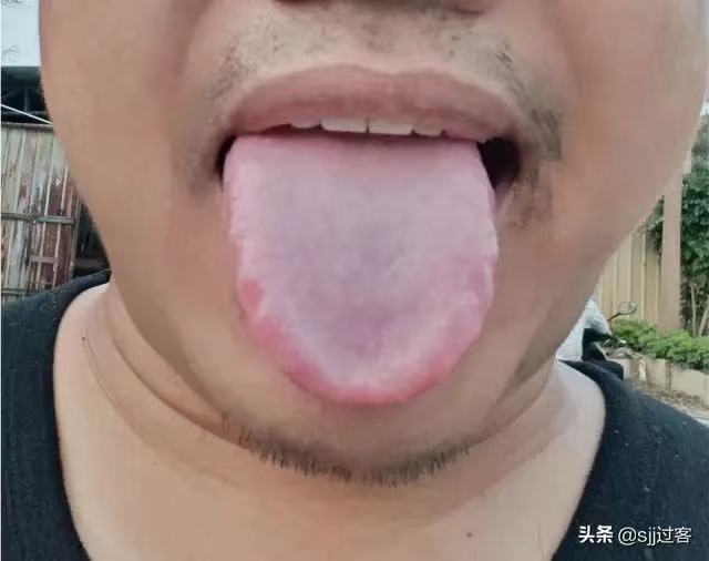 气虚导致的大汗淋漓怎么调,一动就大汗淋漓是体虚吗