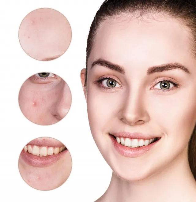 学生党祛痘印最快方法,什么东西祛痘印最快最有效