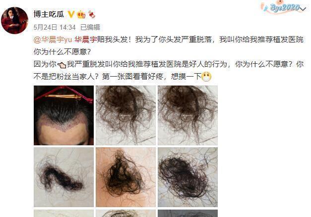 我证明：纯情少年华晨宇真的没有整容没有植发没有情人没有私生子