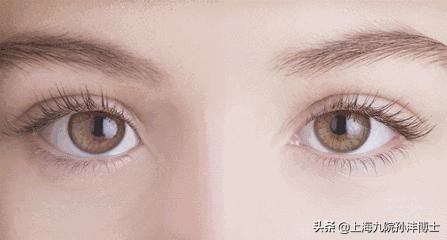 上海九院孙沣博士眼角修复,孙沣修复外眼角