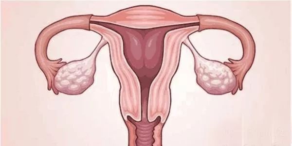 没做过人流，为何也成为输卵管堵塞的受害者？