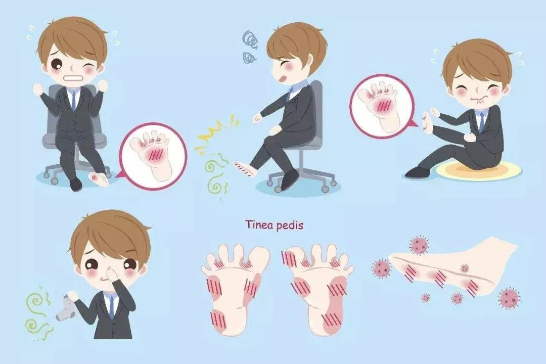 脚气痒的感觉,脚气脚底板走路感觉有个疙瘩