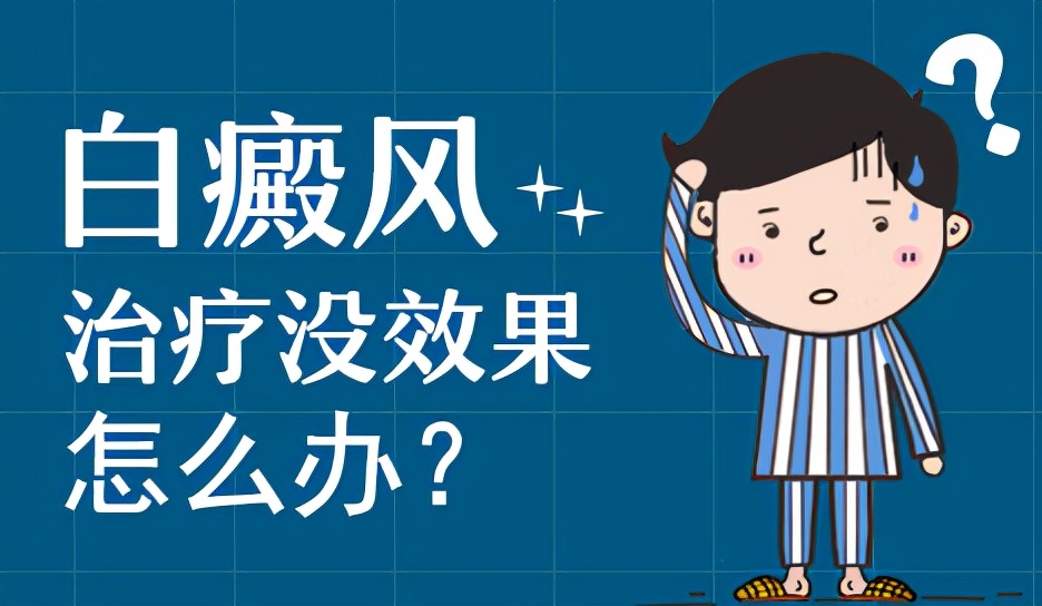 白癜风灯光治疗能治疗好吗,治疗白癜风有效的外用药