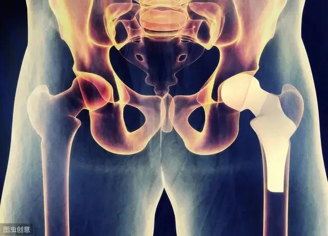 骨科术后康复训练要多久,骨科手术20天后恢复