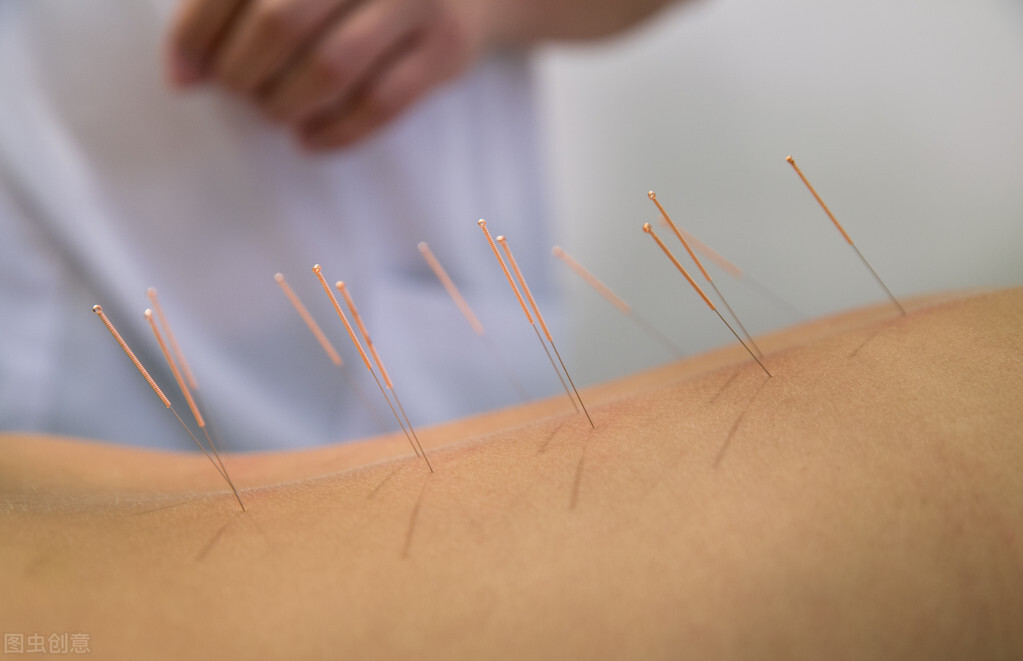 女病人颈肩部疼痛，针灸刺破肺造成气胸，却被老大夫发现另有他症