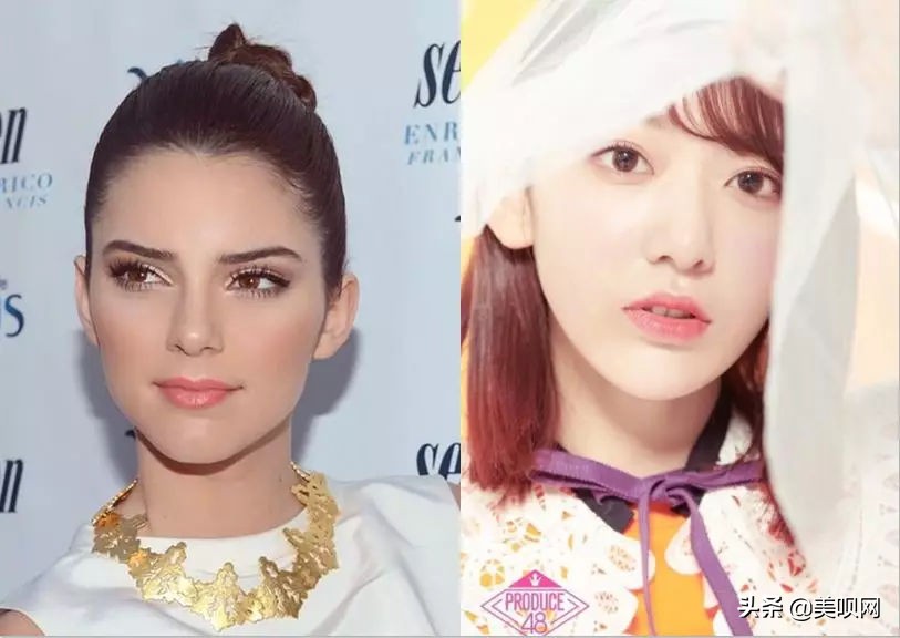 明星都在用的缩小鼻翼神器,明星鼻子做鼻翼缩小外切