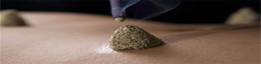 中医养生艾灸知识,中医养生艾灸养生知识讲解