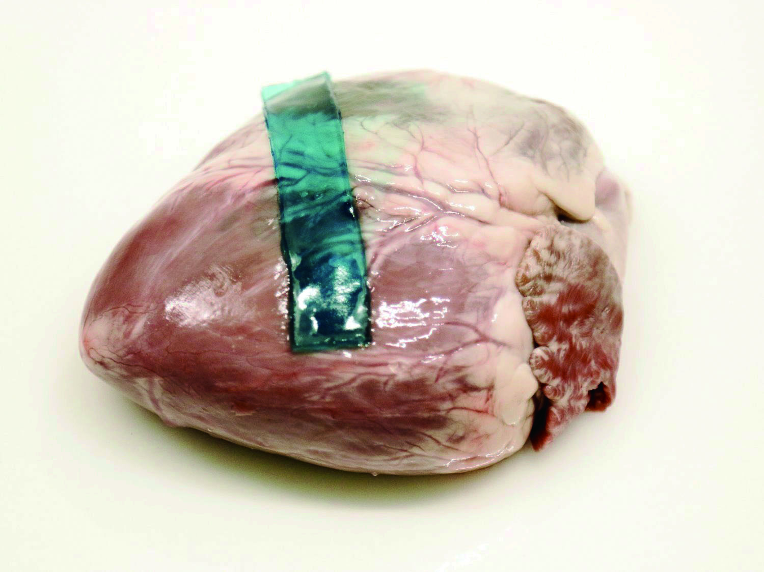 手术后免拆线用温水洗线会融化吗,医用胶水缝合伤口几天会愈合